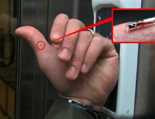 Locked Out Of His Own Hand: The Microchip Mishap & The Prophetic Future