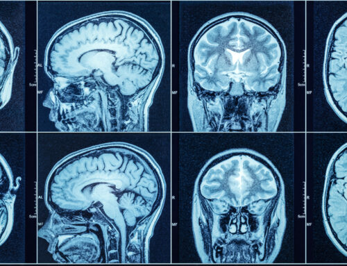The Human Brain Is Better than Artificial Ones